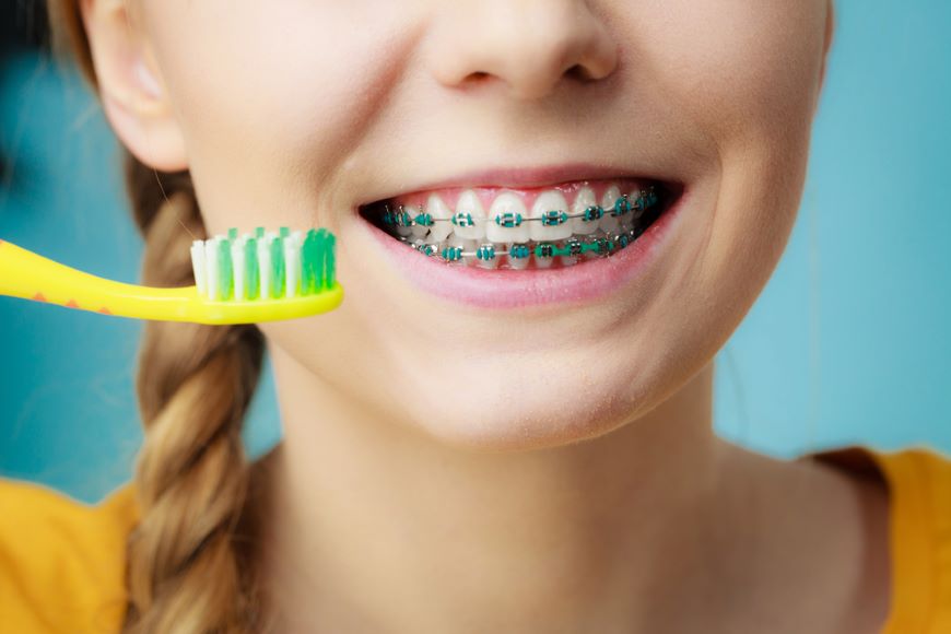 Jak čistit zuby s rovnátky